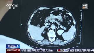 18岁每周3顿烧烤患胃癌An 18-year-old develops stomach cancer after eating BBQ three times a week.