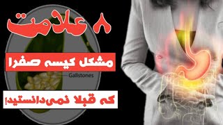 علائم سنگ کیسه صفرا؛ علائم و نشانه های که نشان می دهند مشکل کیسه صفرا دارید!