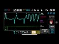 defibrillation and cardioversion