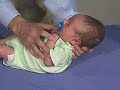 physical exam newborn normal primitive reflexes moro