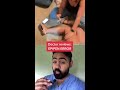 doctor reacts to epic epipen error shorts