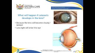 Grade 12 The Eye & Ear   consequences to damages of the parts