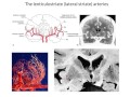 The lenticulostriate vessels and lacunar infarcts