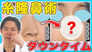 【糸の鼻整形】切らない鼻整形のダウンタイム｜針穴はどのくらい目立つ？