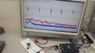 超音波プローブの伝搬特性テスト－－低周波の共振現象と、高周波の非線形現象を発振制御するメガヘルツの超音波システム技術ーー（超音波システム研究所）