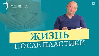 Что нельзя делать после пластической операции?