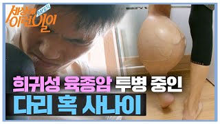 희귀성 육종암 투병중인 ‘다리 혹 사나이’ @순간포착 세상에 이런일이 956회 20170928