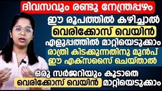 ദിവസവും രണ്ടു നേന്ത്രപ്പഴം ഈ രൂപത്തിൽ കഴിച്ചാൽ വെരിക്കോസ് വെയിൻ എളുപ്പത്തിൽ മാറ്റിയെടുക്കാം