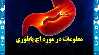 H. pylori, all you need to know / معلومات در مورد اچ پایلوری