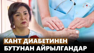 Кант диабетинен бутунан айрылгандар