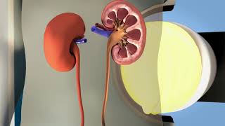 Lithotripsy Trailer | Biomedical Engineers TV |