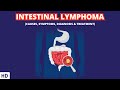 The Silent Killer: Understanding Intestinal LymphomaIntestinal Lymphoma