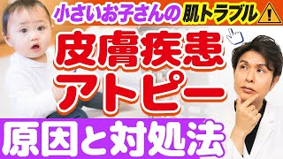 お子さんの皮膚疾患 ( アトピー ) について皮膚科専門医が解説