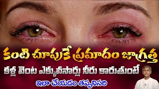 How to Improve Eyes Health | Effects of Watery Eyes | Dry Eyes | Dr. Manthena's Health Tips