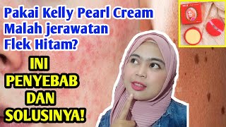 Pakai Kelly malah Jerawatan dan Flek Hitam? Ini Penyebab dan Solusinya