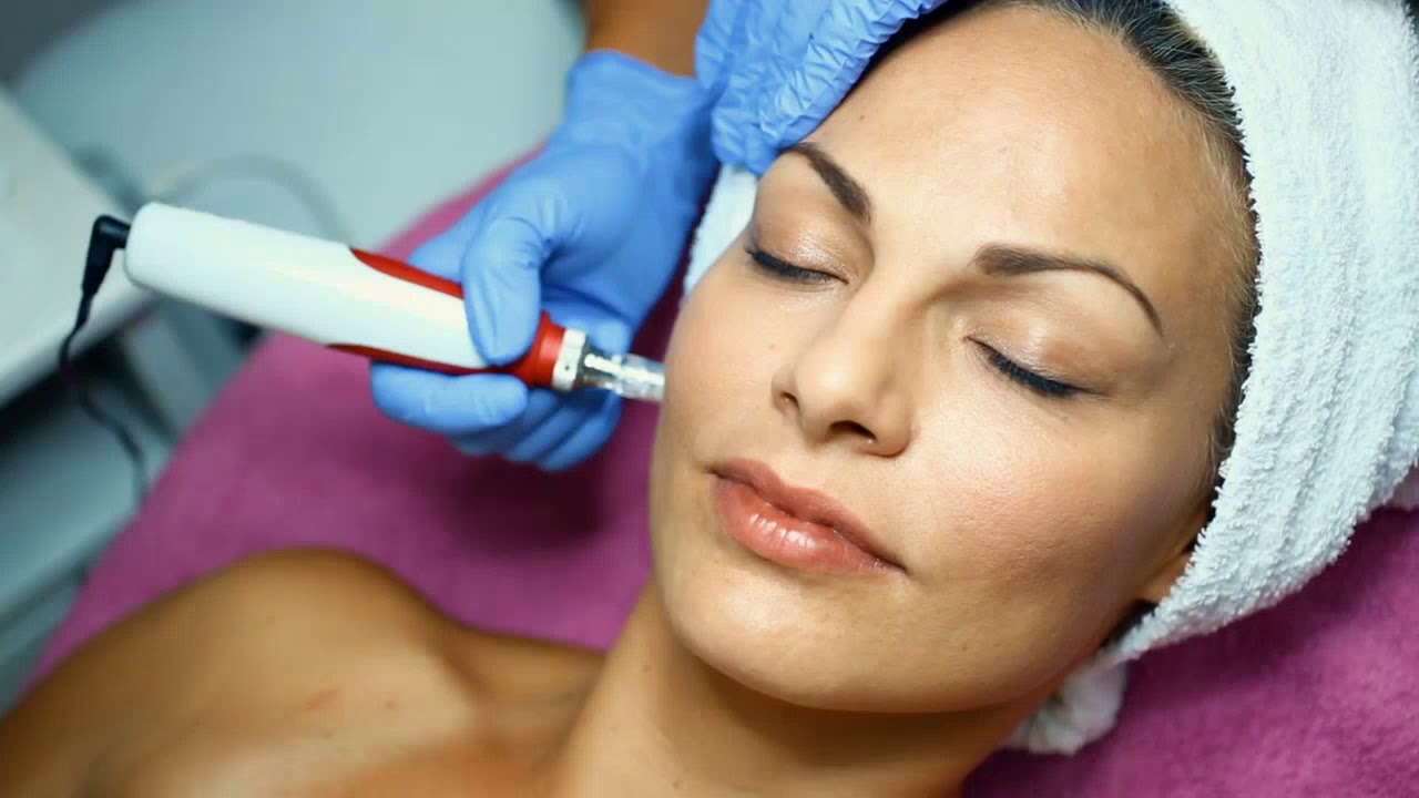 Microneedling (Collagen Induction Therapy) - YouTube