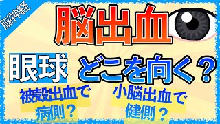 イラストで学ぶ医学！「脳出血の眼球症状まとめ」被殻出血で病側に共同偏視が起こる理由/小脳出血で健側に共同偏視が起こる理由/PPRF