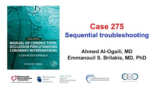 Case 275: Manual of CTO PCI - Sequential troubleshooting
