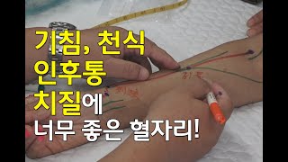 [김효열 교수의 재미있는 혈자리 공부] 인후통, 기침, 천식, 치질 등에 좋은 혈자리(수태음폐경)