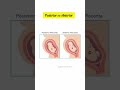 Posterior vs Anterior placenta #posterior #anterior