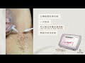 yanis beauty • 皮膚「疣」問題 點算好？