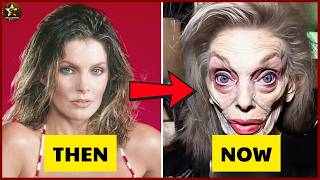10 Stars Whose Plastic Surgery Went Horribly Wrong