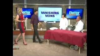 Dr. Luis Navarro on the Better Show Vanishing Veins