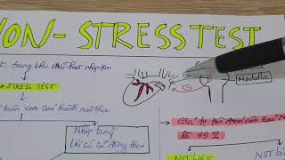 Cách đọc CTG cơ bản 3 - Non-stress test | Bài giảng sản khoa YDS 2020