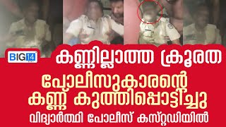 കണ്ണില്ലാത്ത ക്രൂരത: പോലീസുകാരന്റെ കണ്ണ് കുത്തിപ്പൊട്ടിച്ചു; വിദ്യാർത്ഥി പോലീസ് കസ്റ്റഡിയിൽ