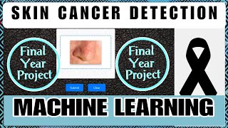 Skin Cancer Detection Using Machine Learning|Python Projects|Finalyear Projects|Bme Project#project