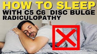 Ep19 How To Sleep With C5 C6 Disc Bulge Radiculopathy | Dr. Walter Salubro Chiropractor in Vaughan