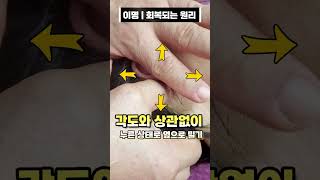 이명은 바닥에 붙은🕳️ 껌과 같아요! 떼어내면 그만이죠!🪠