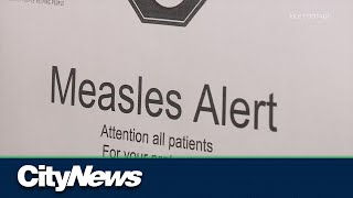 'Unique' Ontario measles case under investigation