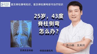 25岁，43度脊柱侧弯，怎么办？