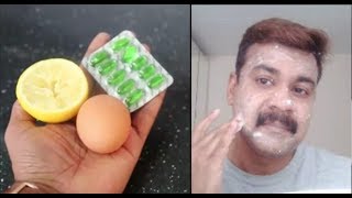 Super Face Pack With EGG || മുട്ടയുണ്ടോ കൈയിൽ മുഖം പള പളാന്ന്  തിളങ്ങും