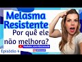 Principais causas de melasma resistente