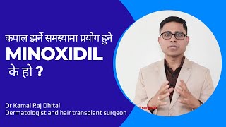 कपाल झर्न रोक्ने तेल minoxidil solution l कपाल झर्न रोक्ने तरीका l Dr Kamal Raj Dhital