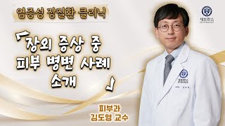 염증성 장질환 건강강좌8