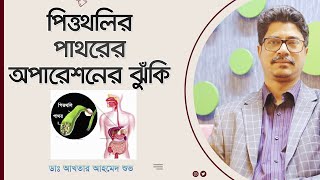 পিত্তথলির পাথরের অপারেশনের ঝুঁকি | Risk Of Gallbladder Stones Surgery