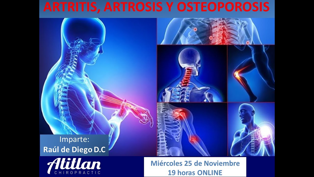 ARTROSIS - ARTRITIS Y OSTEOPOROSIS - YouTube