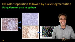 278 - IHC color separation followed by nuclei segmentation using python