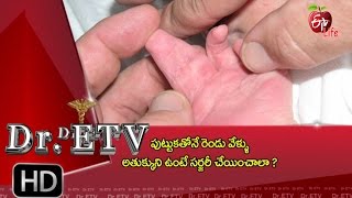 Dr.ETV - Congenital fingers - 2nd June 2016 - డాక్టర్ ఈటివీ