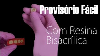 Provisório Fácil Com Resina Bisacrílica