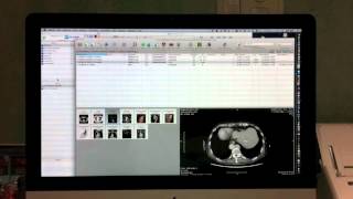 Osirix DICOM Demo