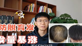 木汐云洗发水真的防脱发吗，生发效果怎么样？真的能长头发吗？