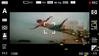 Split Face Diving Accident Diving Face Split Face Split Diving Accident Dna