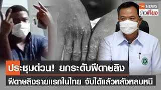 สธ.ประชุมด่วน! ยกระดับฝีดาษลิง-ฝีดาษลิงรายแรกของไทย จับได้แล้ว | TNNข่าวเที่ยง | 24-7-65