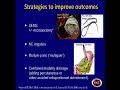 pancreatic fluid collections necrosis when and how to intervene sd