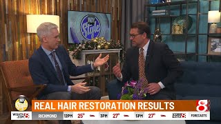 We Grow Hair Indy Discusses Platelet Rich Plasma (PRP) to Fight Hair Loss on Indy Style