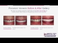 Animated videos for Dentists Demo - Blunt Brit Videos